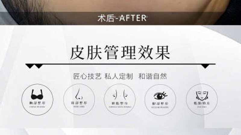 小标题：哺乳期，美容注射的隐忧