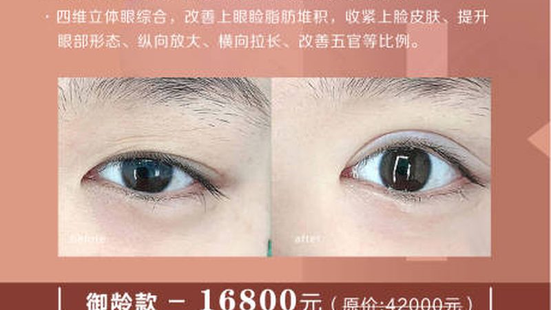 揭秘皮肤管理加盟合同中的隐藏费用陷阱