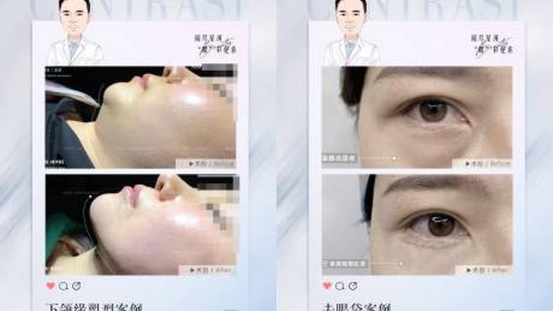 公立医院整形科 VS 私立医院：揭秘两者差异，助你明智选择