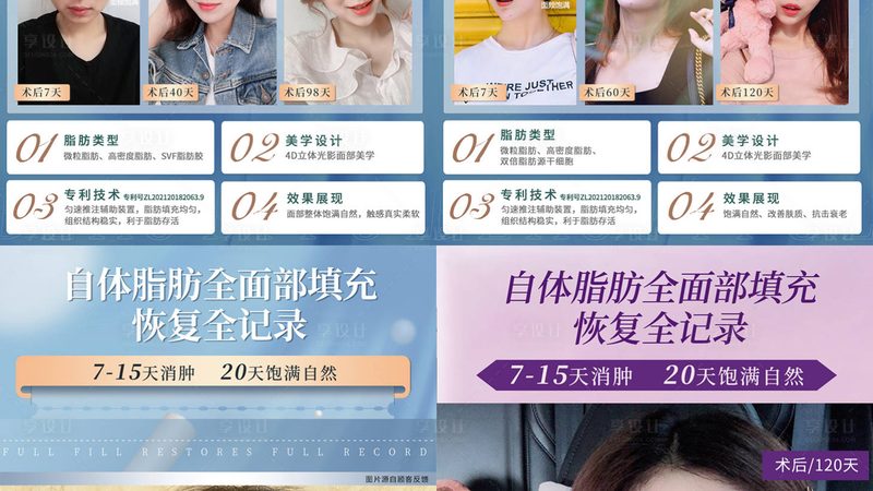 家用激光脱毛仪选购攻略：如何避开陷阱，找到售后好品牌