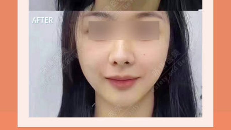 轻医美术后修复精华液：揭秘其价格背后的秘密