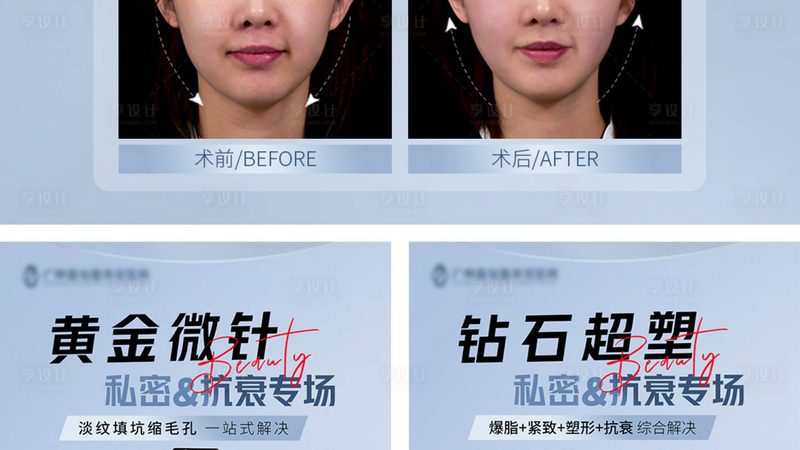 肉毒素注射后表情僵硬？揭秘注意事项与预防措施