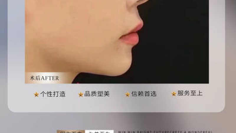透明质酸：天然保湿，安全可靠
