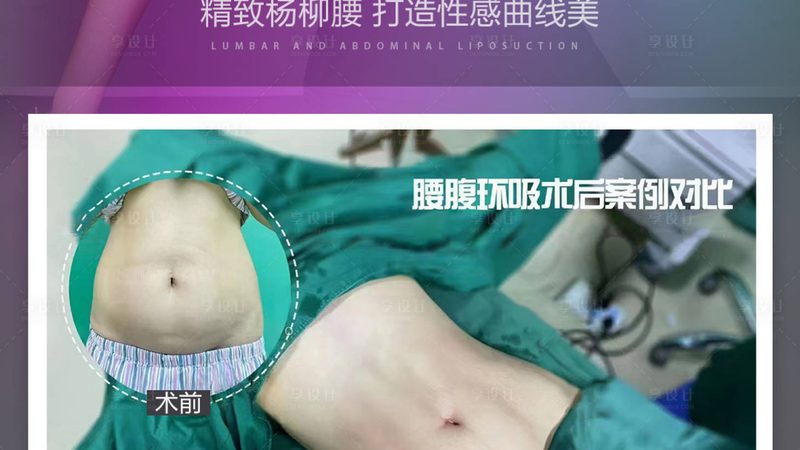 小标题：术后护理的重要性