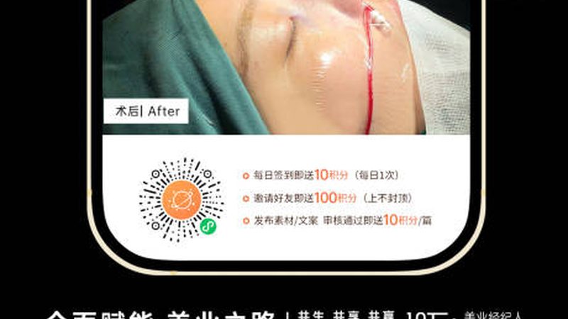 家用超声炮加盟代理：揭秘技术与市场**