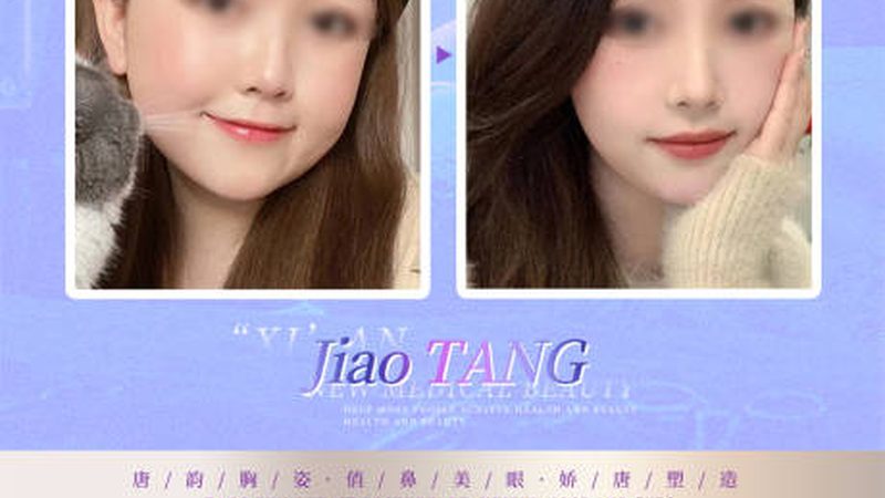 激光祛斑反黑能自愈吗