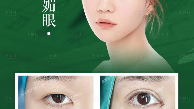 超声炮探头材质区别对比