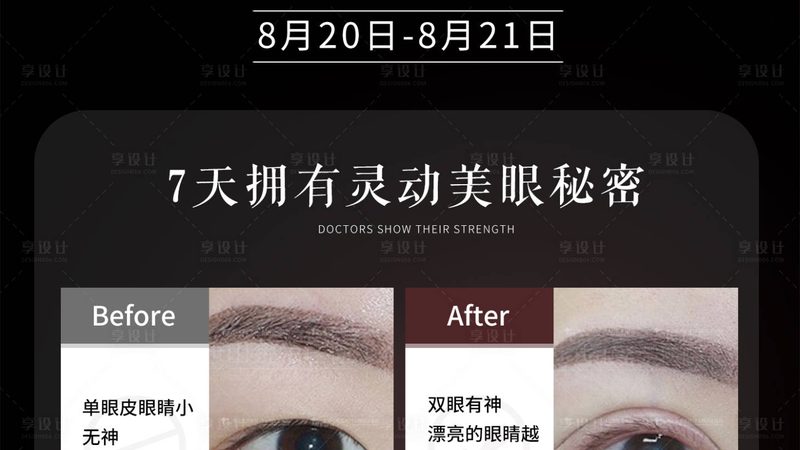 成都玻尿酸代理，资质要求揭秘