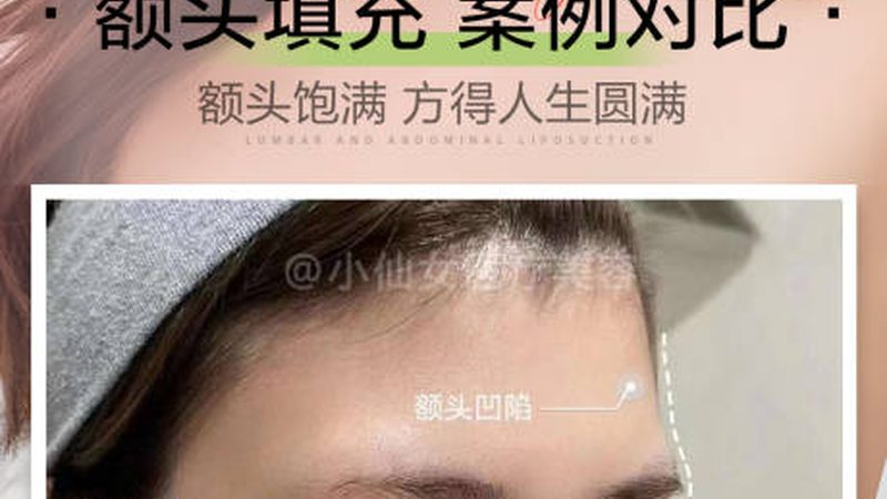 面部医美项目，副作用真的那么可怕吗？**